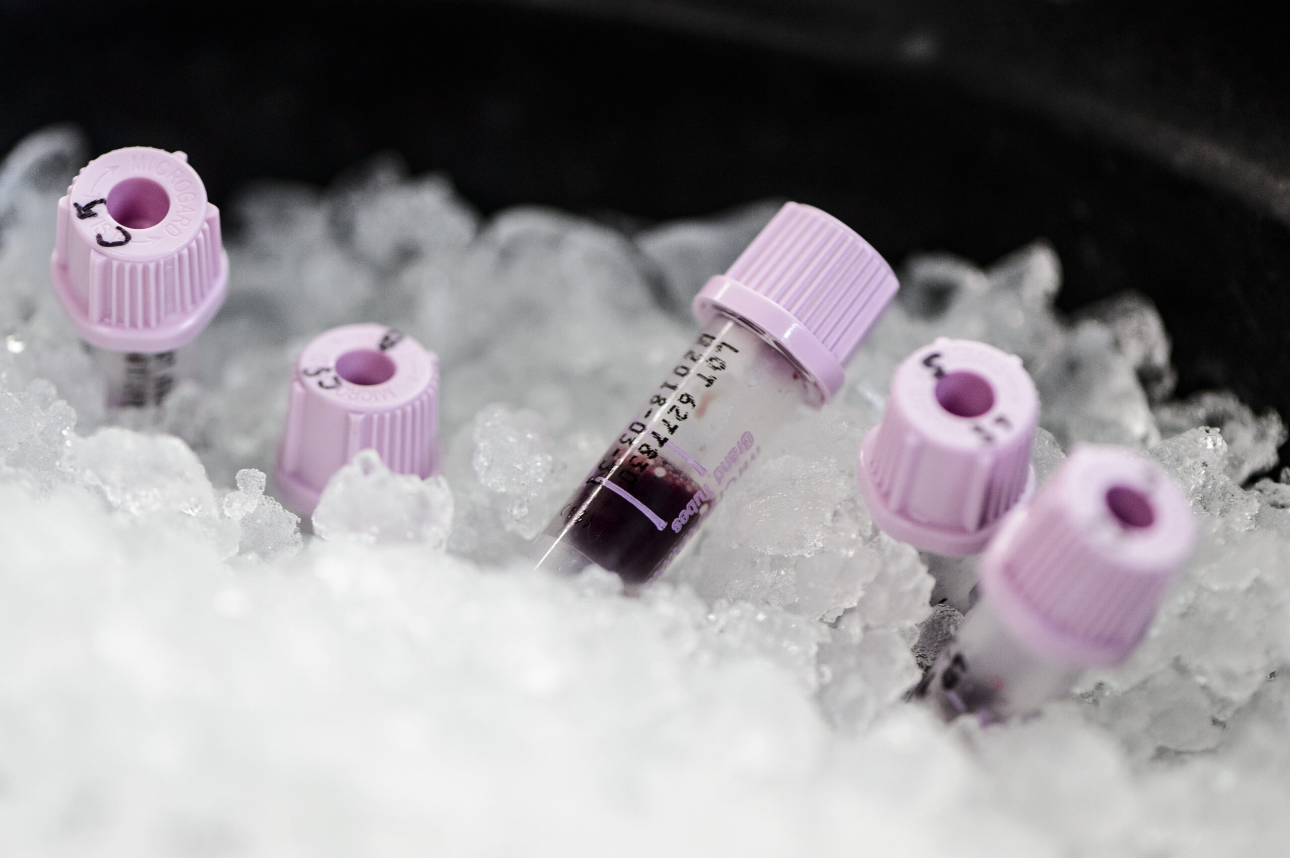 fish blood in test tubes