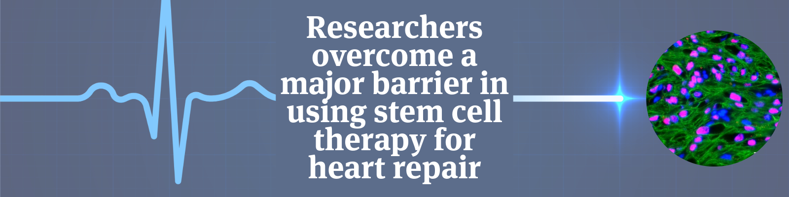 A heart cell image with the title of the article against a grey/blue background